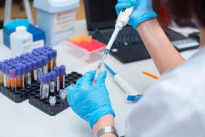 blood test being analyzed at a lab