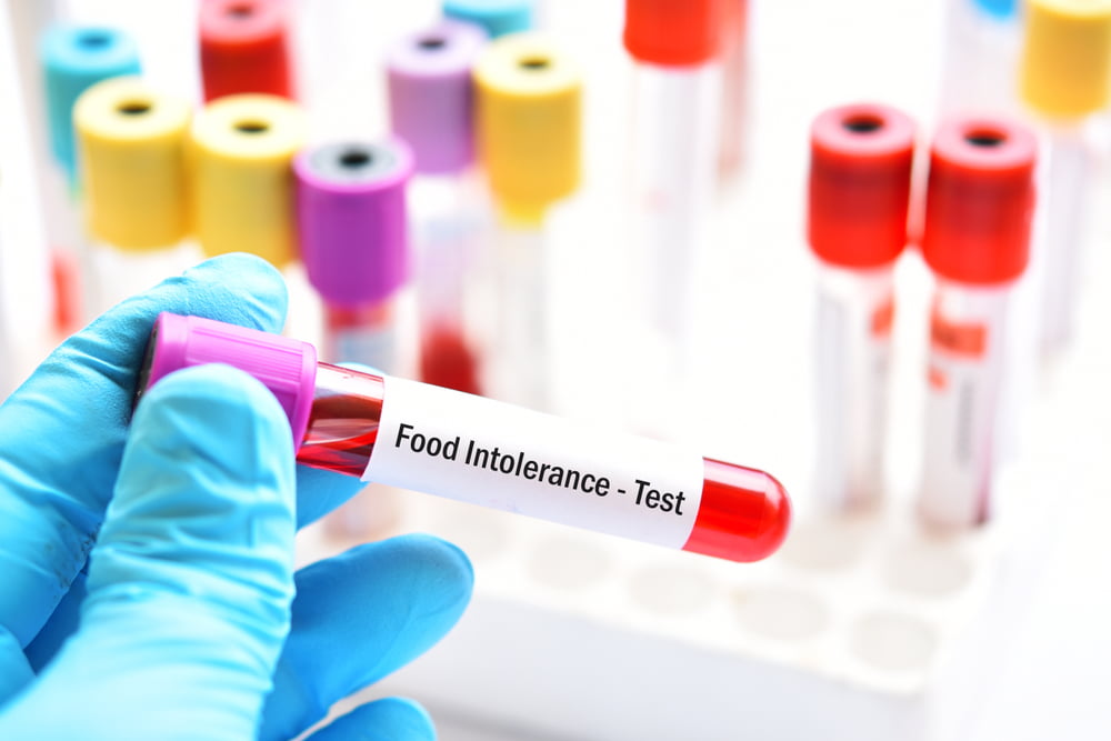 food sensitivity testing