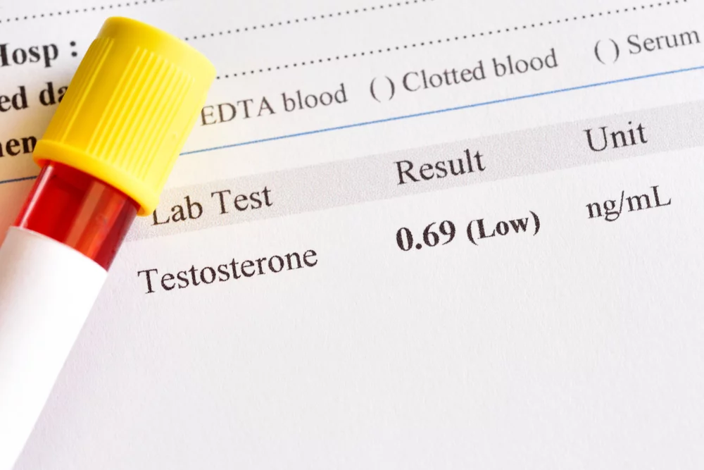 testosterone blood test