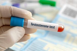 testosterone hormone bloodwork