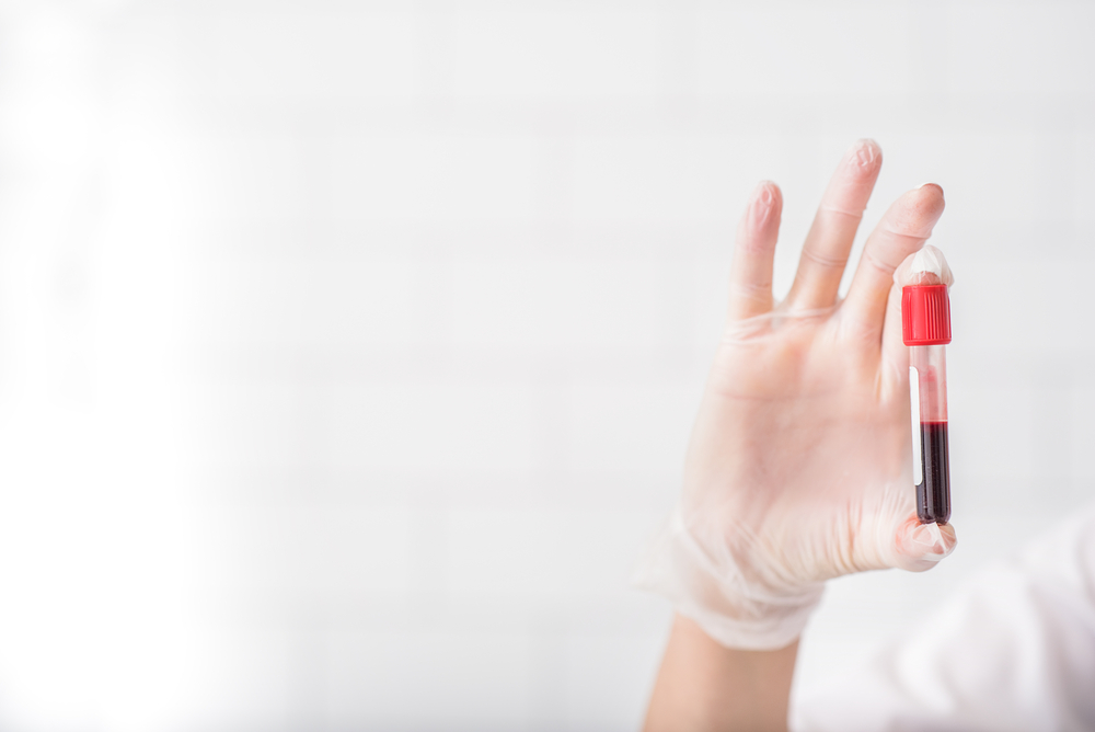 functional medicine lab testing